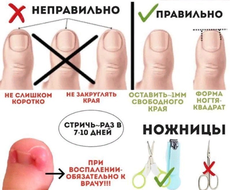 Как стричь ногти детям взрослыми ножницами Как стричь ногти детям взрослыми ножницами